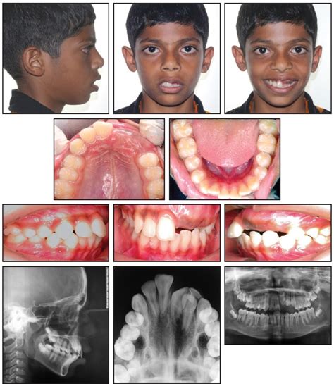 CASE REPORT JCO Online Journal Of Clinical Orthodontics