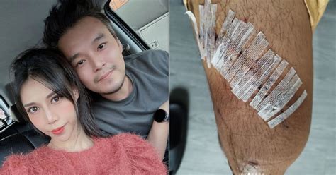 Understanding The Implications Of Joshua's Motorcycle Accident: A 2024