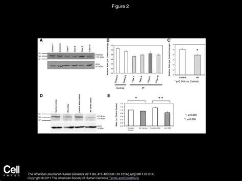 Mutations Of Polr3a Encoding A Catalytic Subunit Of Rna Polymerase Pol