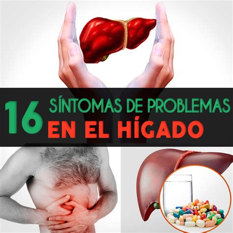 16 señales de que tienes problemas en el hígado La Guía de las Vitaminas