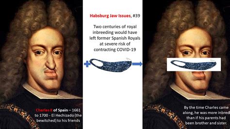 The Habsburg Jaw: The Royal Deformity Caused By Centuries, 50% OFF