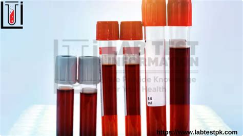 Hematocrit Test