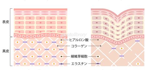 しわと健康な肌 断面図 イラスト素材 6513220 フォトライブラリー Photolibrary