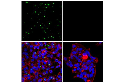 KISS1 E4N8S Rabbit MAb Cell Signaling Technology