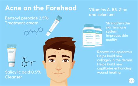 Forehead acne causes and treatments | MDacne