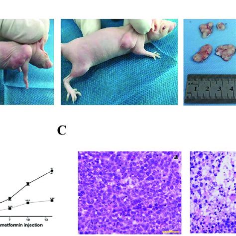 Metformin Inhibited Tumor Growth In Vivo Akyse 450 Xenograft Treated Download Scientific