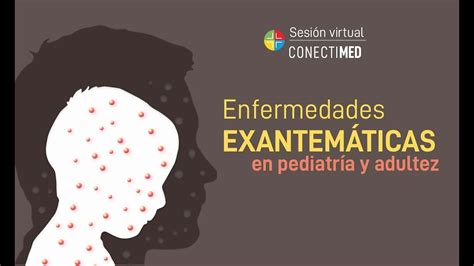 Sesión Virtual Enfermedades Exantemáticas En Pediatría Y Adultez Youtube