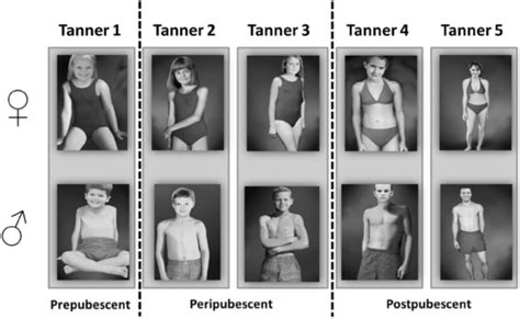 Tanner Scale Sex Maturity Rating