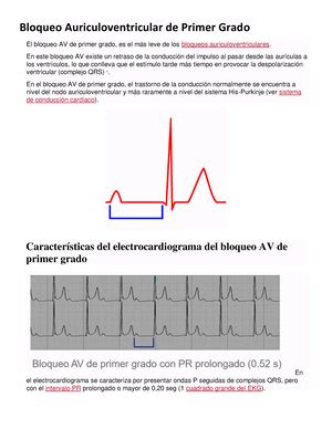 Bloqueo Incompleto de Rama Derecha Criterios electrocardiográficos