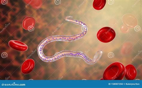 Wuchereria Bancrofti The Causative Agent Of Lymphatic Filariasis Stock Illustration