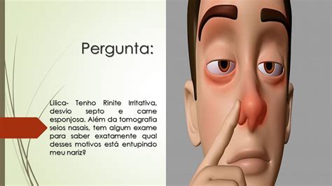 Tenho Rinite Irritativa Desvio De Septo E Carne Esponjosa Como Saber