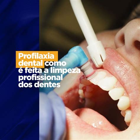 Profilaxia dental como é feita a limpeza profissional dos dentes Gnatus