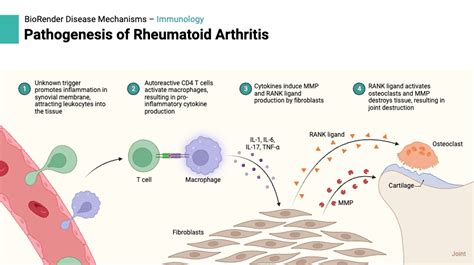 Pathogenesis Of Rheumatoid Arthritis Biorender Science Templates