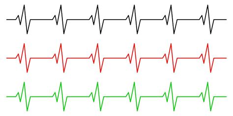 Ekg Line Vector At Collection Of Ekg Line Vector Free