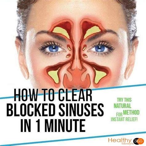 Remedies For Bad Sinuses And Allergies