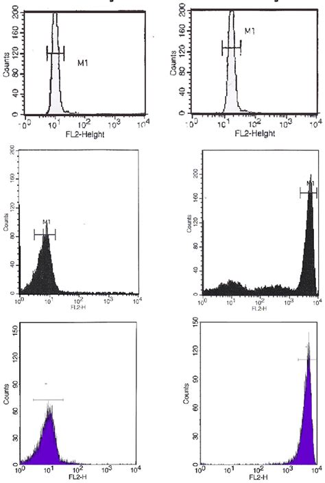 The Dihydrorhodamine Dhr Test Results Of The Patient Comparing Before