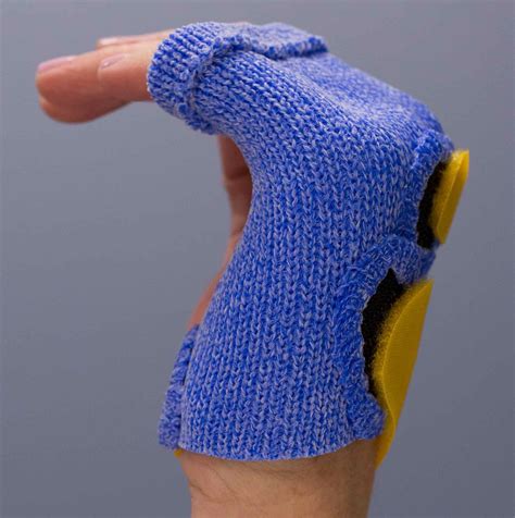 Radial Gutter Hand Splints