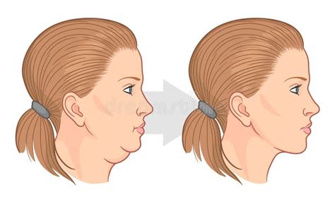 Chin Stock Illustrations 8581 Chin Stock Illustrations Vectors