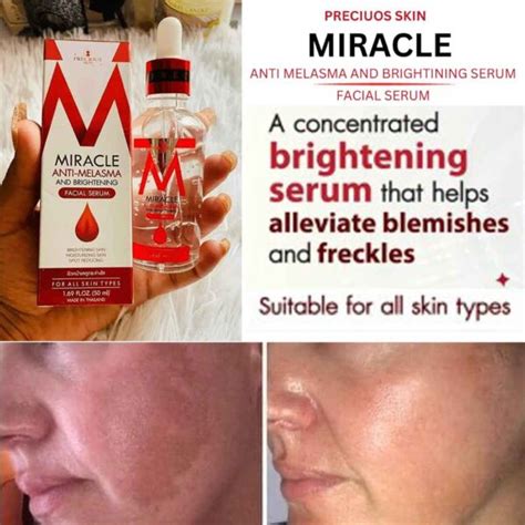 Miracle Anti Melasma Serum And Brightening Price In Bangladesh