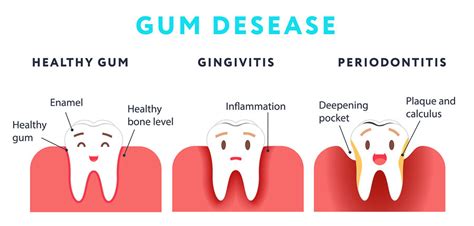 Loose Adult Tooth? Here's What to Do