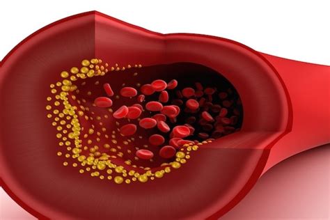 Valores Normales Para Cada Tipo De Colesterol Ldl Hdl Vldl Y Total Tua Saúde