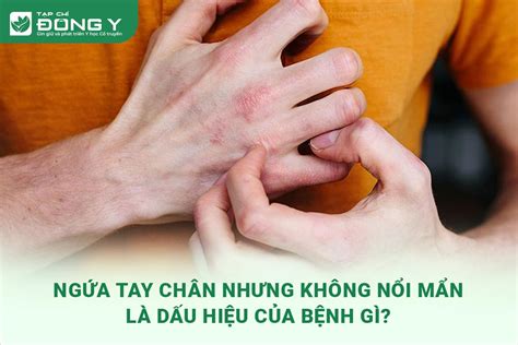 Ngứa Chân Nhưng Không Nổi Mẩn Nguyên Nhân và Giải Pháp Hiệu Quả