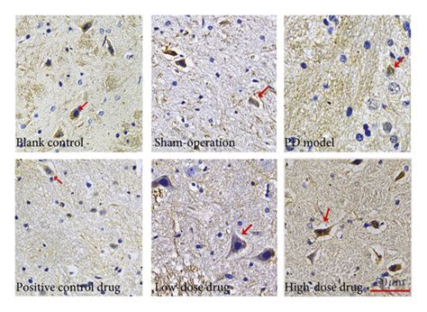 Effect Of PTE And PT On FoxA2 Expression A Expression Of MRNA Levels