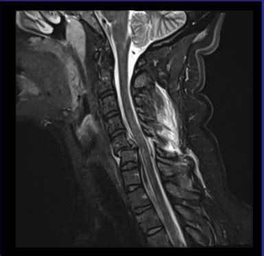 Question Mri Online