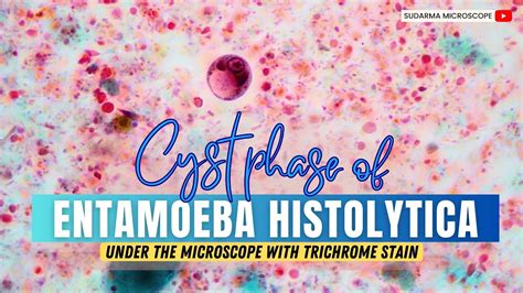 Cyst Phase Of Entamoeba Histolytica Under The Microscope With Trichrome Stain Youtube