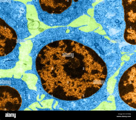 Une couleur par microscopie électronique à transmission MET de