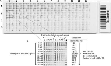 An Example Of A Reverse Phase Protein Array Rppa Slide A Each