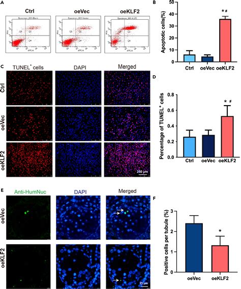 KLF2 Controls Proliferation And Apoptosis Of Human Spermatogonial Stem