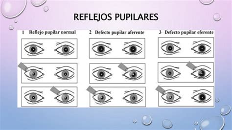 Tecnicas De Exploracion Del Ojo PPT