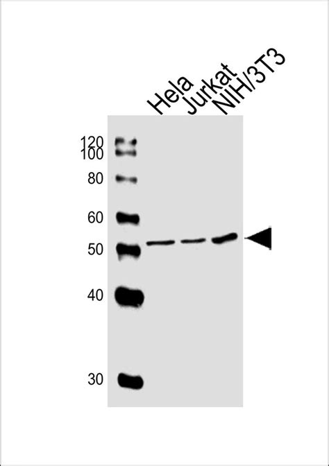 Ppara Antibody Purified Mouse Monoclonal Antibody Mab Ihc P If Fc