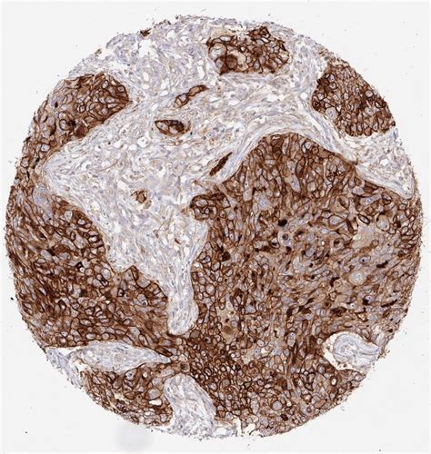 cd antibody clone kk oncodianova cd anti human  ihc