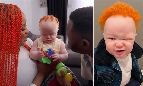 Black mother who gave birth to an albino baby with ginger hair reveals ...