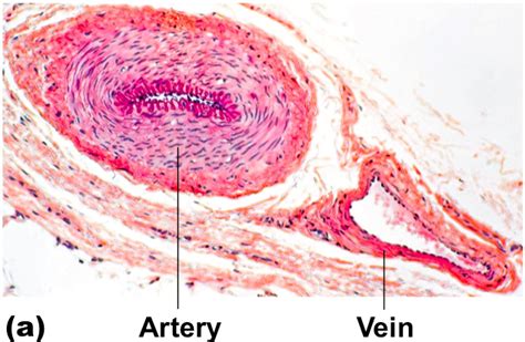 Blood Vessels Ms Gallagher S Classroom