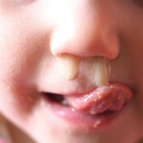 Warum Sex Räume in Kitas für emotionalen Zündstoff sorgen