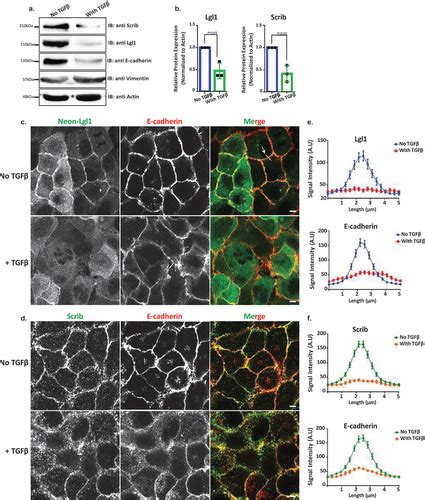 Full Article Scribble Lgl And Myosin Iia Interact With Catenin