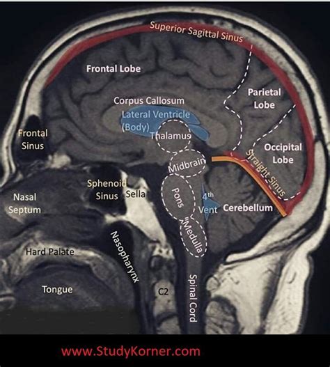 Well Labelled Mri Of The Brain Medical School Studying Radiology