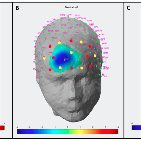 Statistical Parameter Maps Of Significant Hemodynamic Activation During