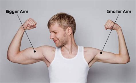 What To Do If You Have One Arm Bigger Than The Other