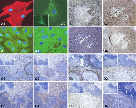 Expression Analysis Of Sma Postn Col And Fibronectin In Pscs As