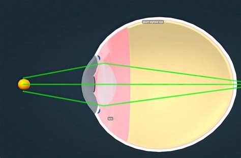 Premium Photo | Structure of the human eye and anatomy of vision