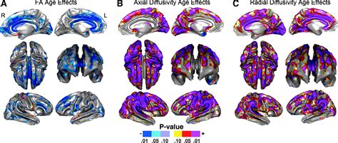 Superficial White Matter Effects Of Age Sex And Hemisphere Brain Connectivity