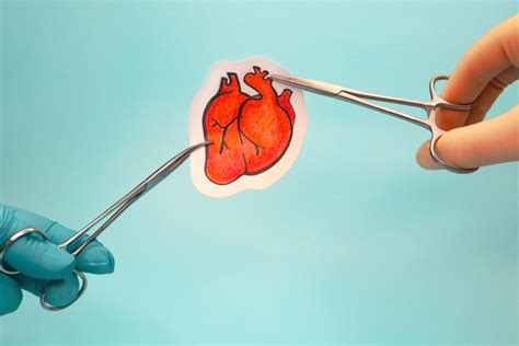 The Impact of Heart Surgery 3D Animation by Austin Visuals