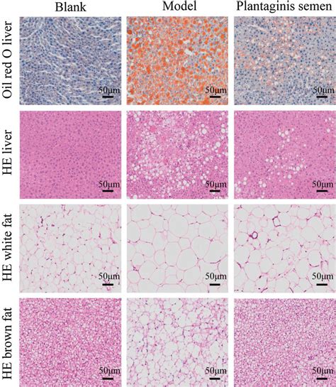 Imaging Of Neutral Lipids By Oil Red O For Analyzing The Off