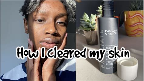 How I Cleared My Skin Paulas Choice 2 Bha Liquide Exfoliant Review