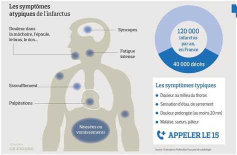 Infarctus Du Myocarde Quelle Douleur Fiches Sant Et Conseils