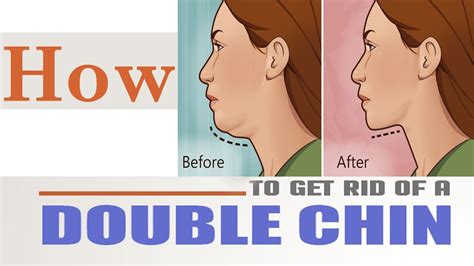 How To Get Rid Of Double Chin How To Lose A Double Chin Fast Double